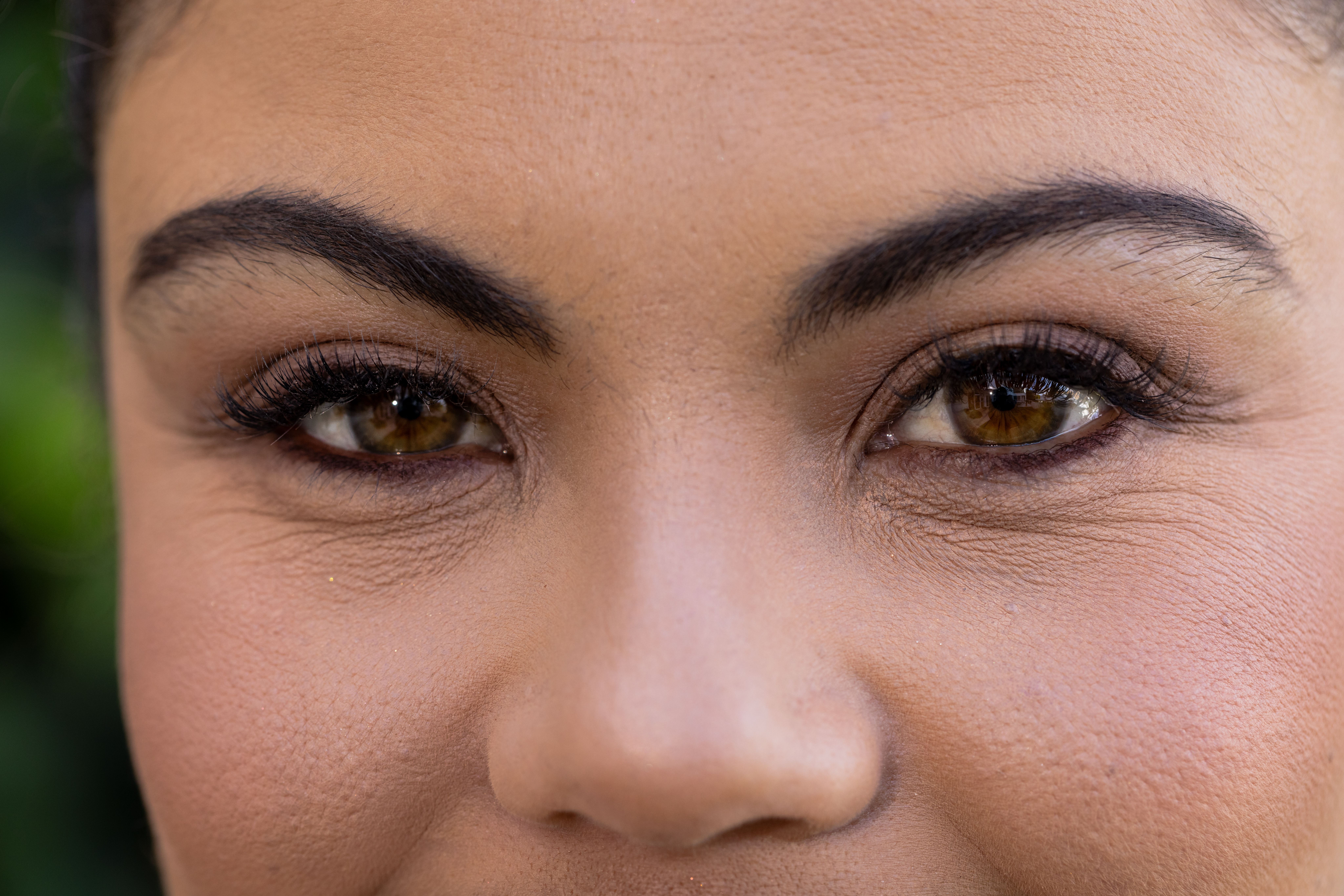 Under-Eye Tightening