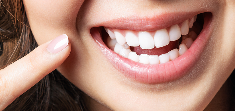 Professional Teeth Whitening